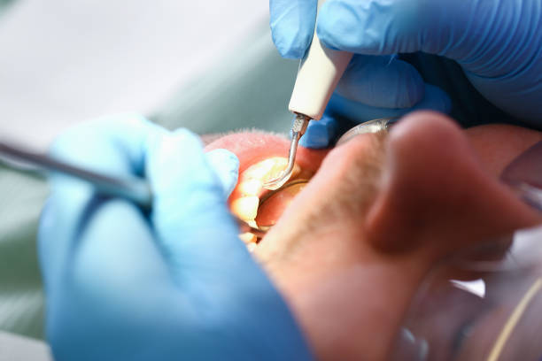 Best Emergency Treatment for Toothache in Grafton, OH